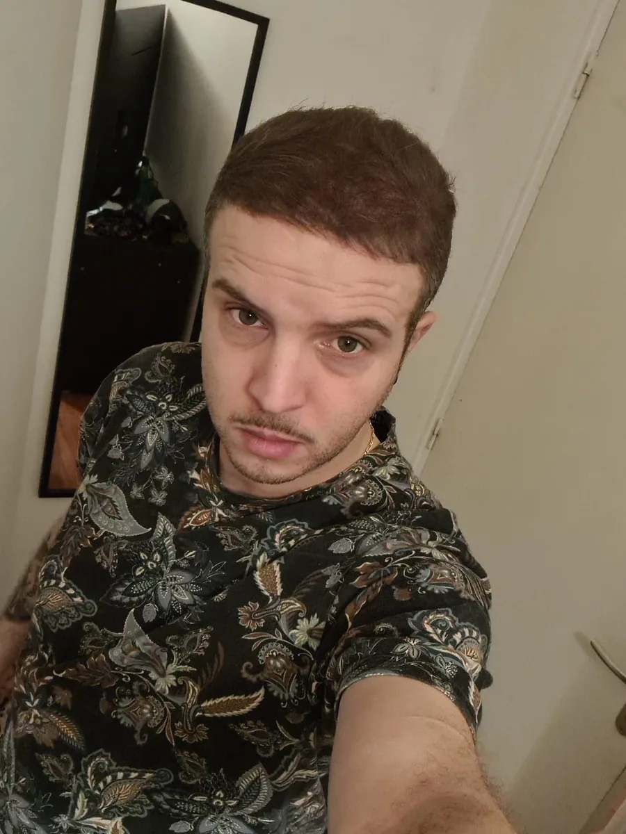 After hair restoration