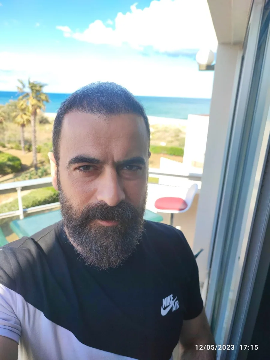 After hair restoration