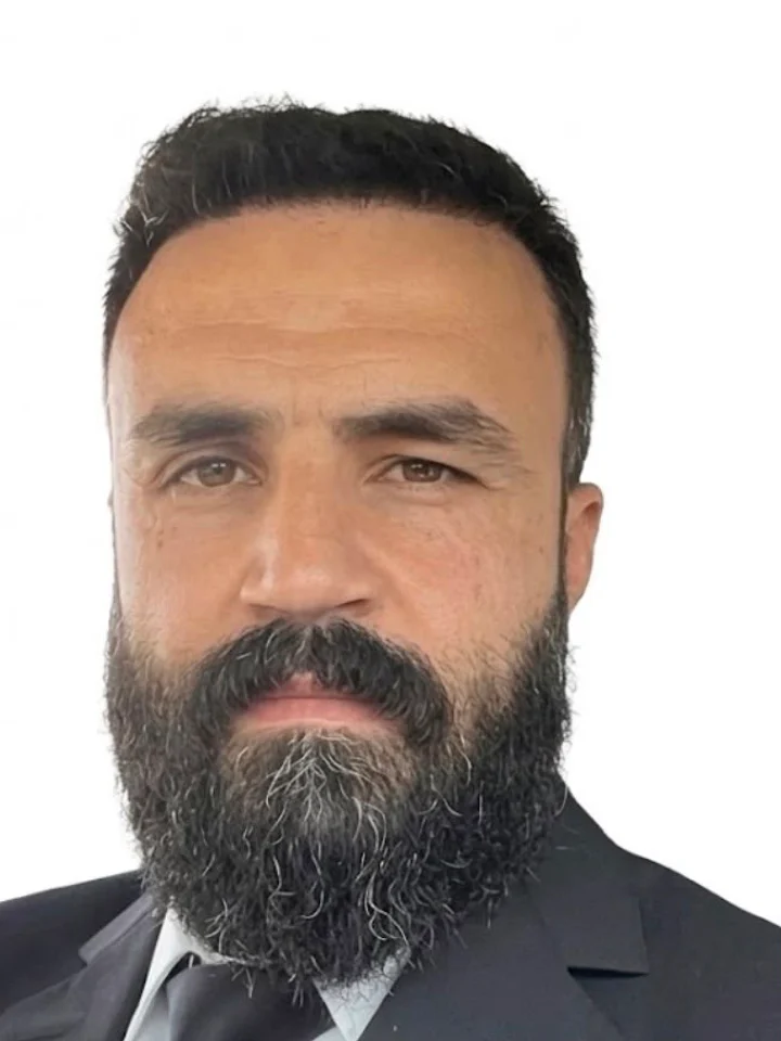 After hair restoration
